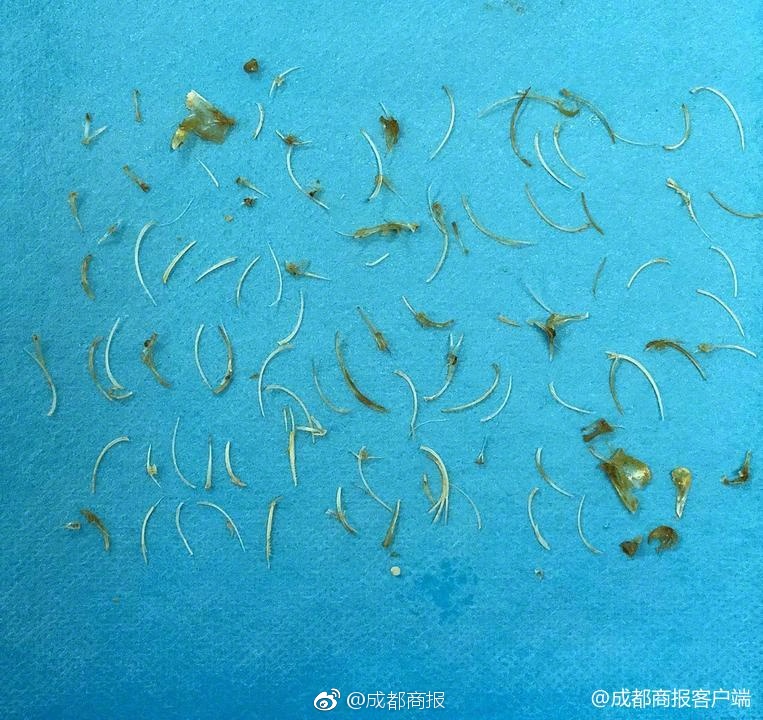 “我們都有病”：瓷娃娃女孩玩搖滾 為罕見(jiàn)病群體發(fā)聲